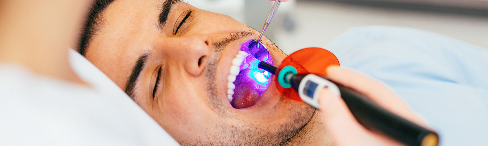 Composite Fillings Long Beach CA