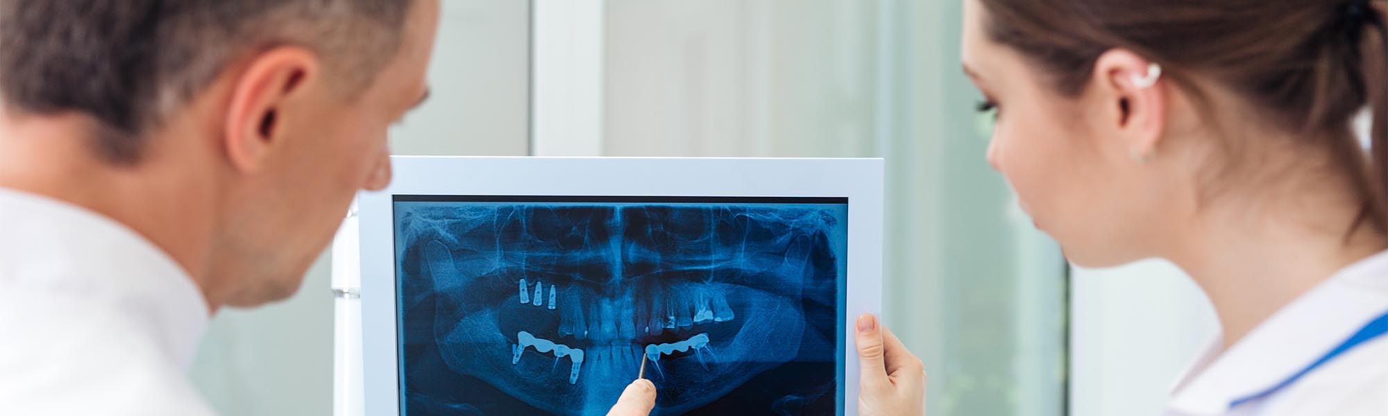 3D Dental Imaging Long Beach CA