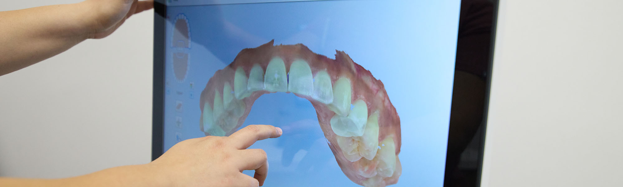 3D Dental Imaging Long Beach CA