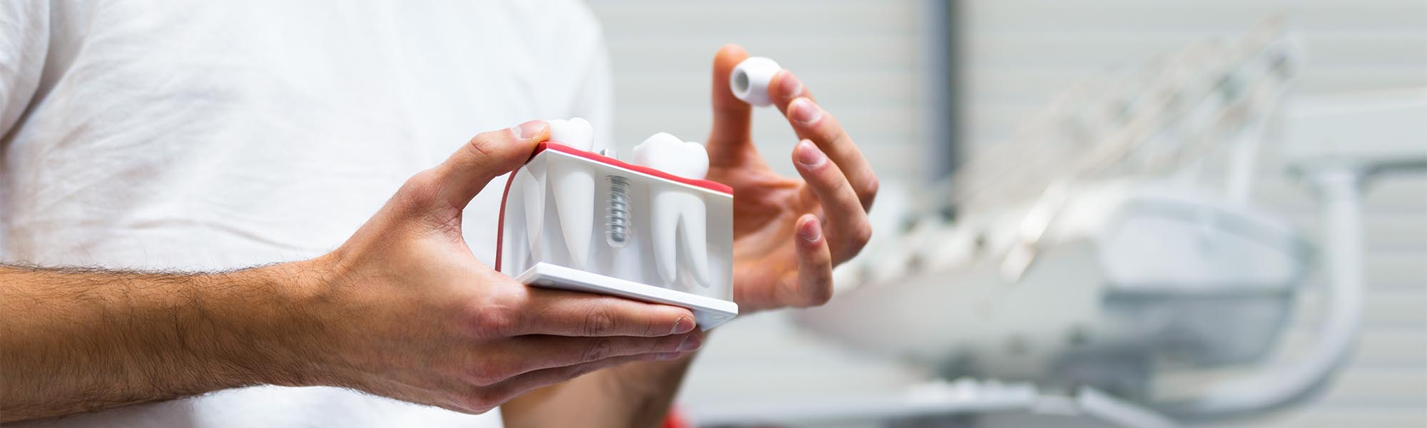 Multiple Teeth Implants in Long Beach CA