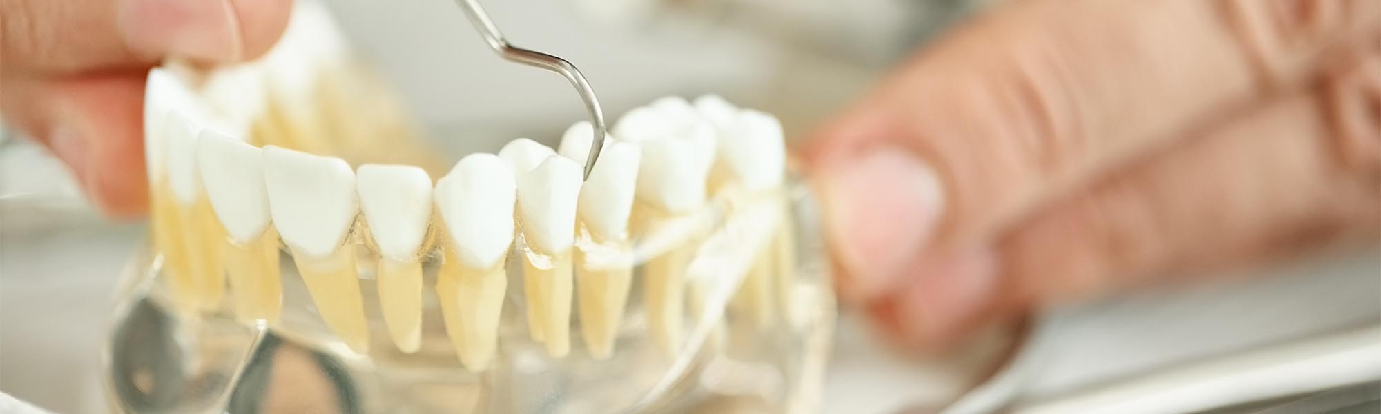 Root Canal Therapy Long Beach CA
