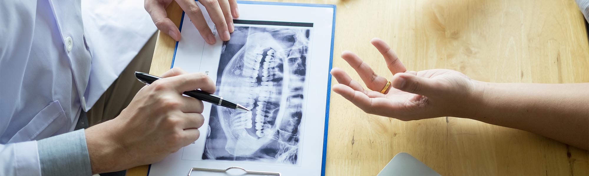 Single Tooth Implants Dentist Long Beach CA