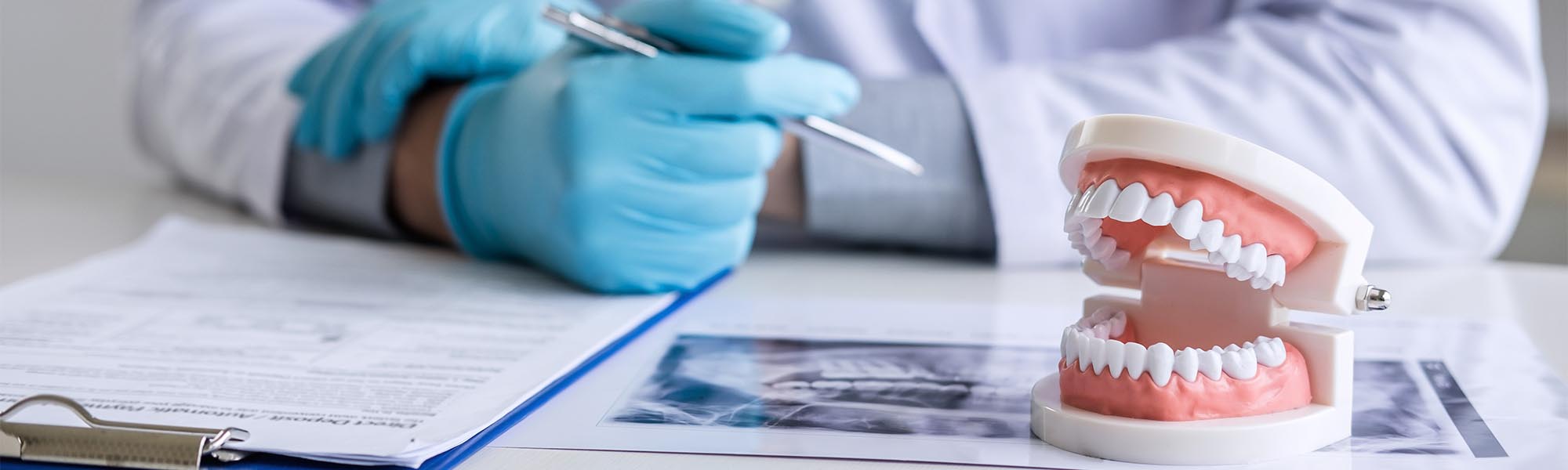 Digital X-rays Dentistry Long Beach CA